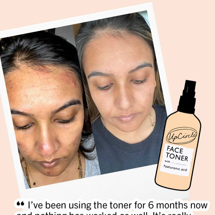 Face Toner with Hyaluronic Acid